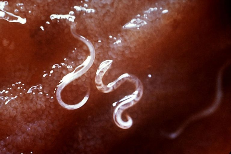 Parasiten