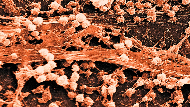 Break Through the Biofilm Barrier